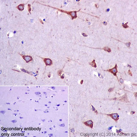Immunohistochemistry (Formalin/PFA-fixed paraffin-embedded sections) - Anti-RCN1/RCN antibody [EPR17163] - C-terminal (AB198996)