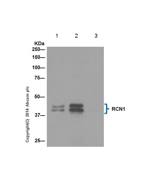 Immunoprecipitation - Anti-RCN1/RCN antibody [EPR17163] - C-terminal (AB198996), expandable thumbnail