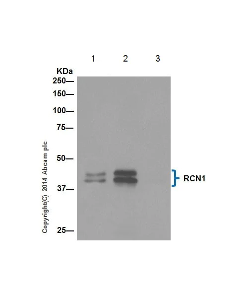 Immunoprecipitation - Anti-RCN1/RCN antibody [EPR17163] - C-terminal (AB198996)