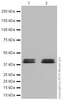 Western blot - Anti-RCN1/RCN antibody [EPR17163] - C-terminal (AB198996), expandable thumbnail