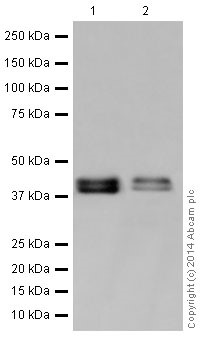 Western blot - Anti-RCN1/RCN antibody [EPR17163] - C-terminal (AB198996), expandable thumbnail