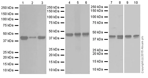 Western blot - Anti-RCN1/RCN antibody [EPR19193] (AB184441)