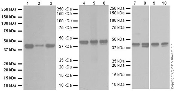 Western blot - Anti-RCN1/RCN antibody [EPR19193] - BSA and Azide free (AB250748), expandable thumbnail