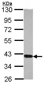 Western blot - Anti-RDH5 antibody (AB101457), expandable thumbnail