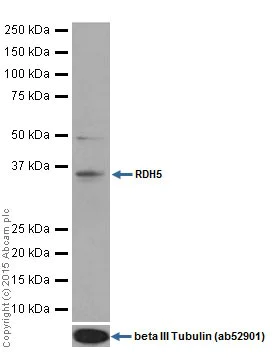 Western blot - Anti-RDH5 antibody [EPR15191] - BSA and Azide free (AB251299)