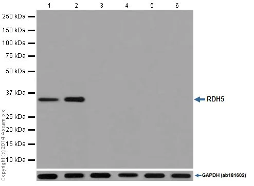 Western blot - Anti-RDH5 antibody [EPR15191] - BSA and Azide free (AB251299)