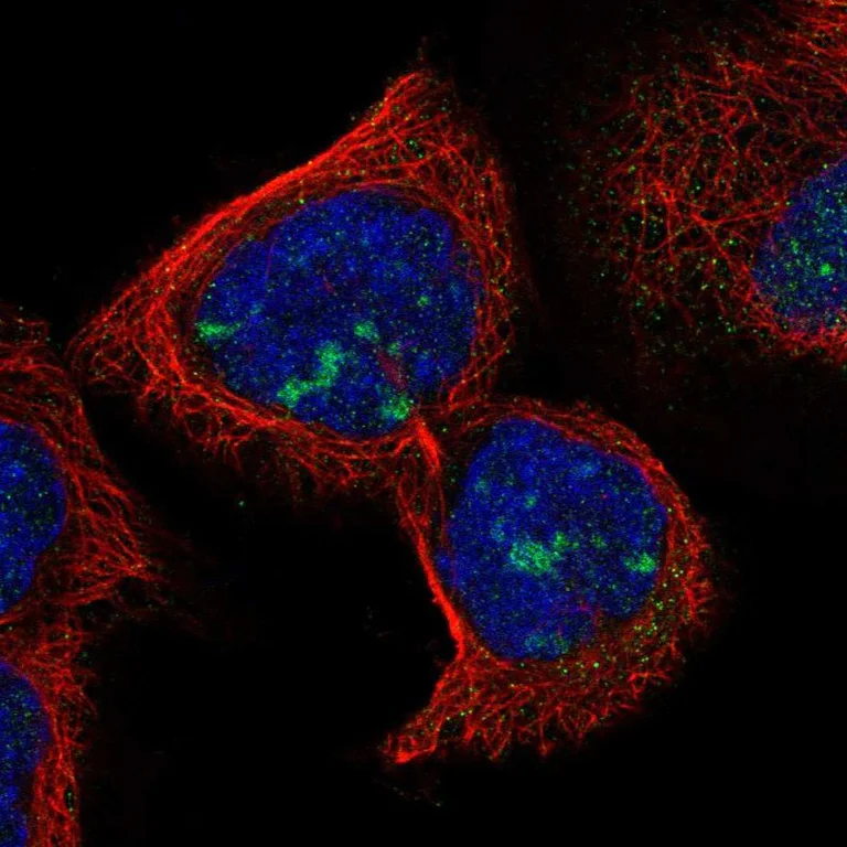 Immunocytochemistry/ Immunofluorescence - Anti-RDM1 antibody (AB254802)