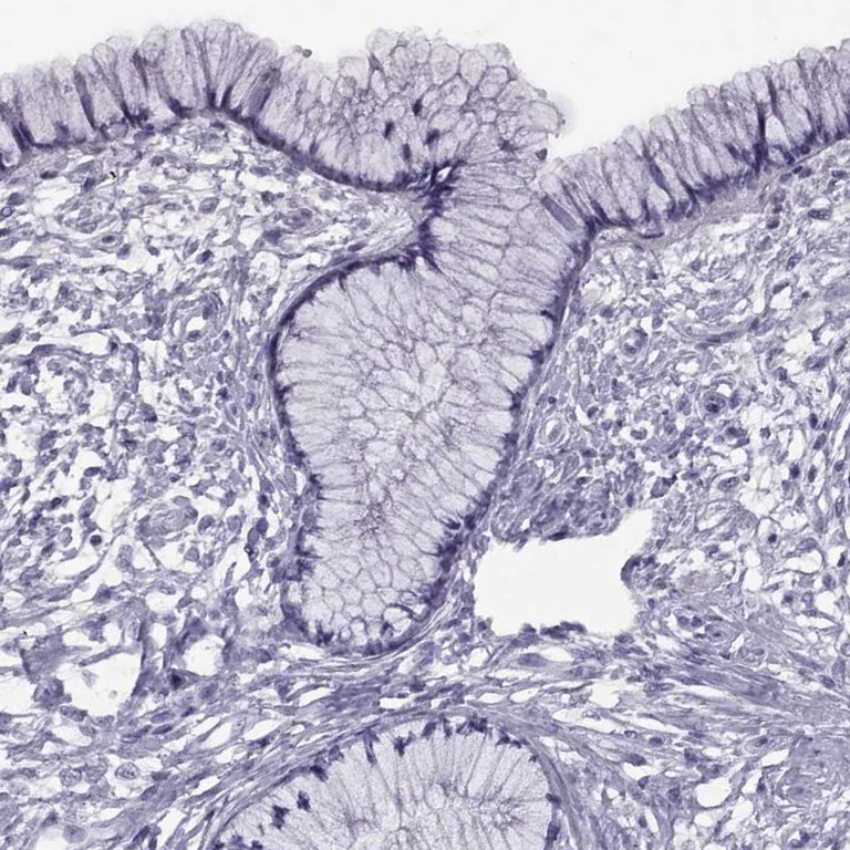 Immunohistochemistry (Formalin/PFA-fixed paraffin-embedded sections) - Anti-RDM1 antibody (AB254803)