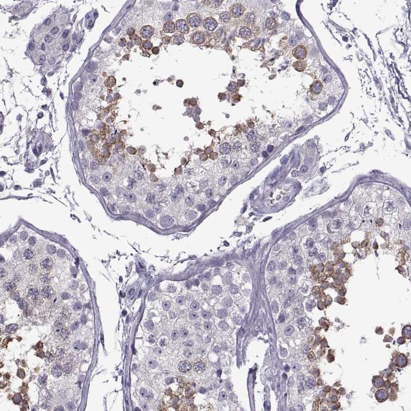 Immunohistochemistry (Formalin/PFA-fixed paraffin-embedded sections) - Anti-RDM1 antibody (AB254803), expandable thumbnail