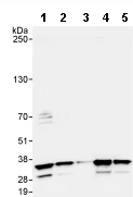 Western blot - Anti-REA antibody (AB71970)