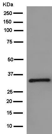 Western blot - Anti-REA antibody [EPR14522] (AB181838)