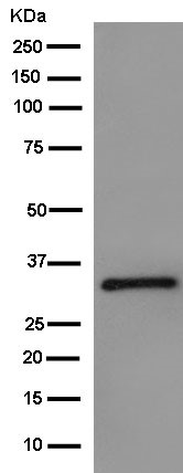Western blot - Anti-REA antibody [EPR14522] - BSA and Azide free (AB250515), expandable thumbnail