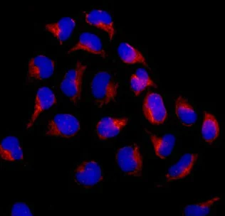 Immunocytochemistry/ Immunofluorescence - Anti-REA antibody [EPR14523] (AB182139)