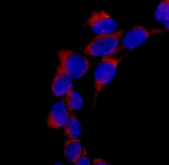 Immunocytochemistry/ Immunofluorescence - Anti-REA antibody [EPR14523] (ab182139), expandable thumbnail