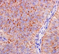 Immunohistochemistry (Formalin/PFA-fixed paraffin-embedded sections) - Anti-REA antibody [EPR14523] (ab182139), expandable thumbnail