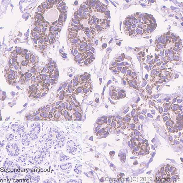 Immunohistochemistry (Formalin/PFA-fixed paraffin-embedded sections) - Anti-REA antibody [EPR14523] (AB182139), expandable thumbnail