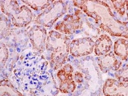Immunohistochemistry (Formalin/PFA-fixed paraffin-embedded sections) - Anti-REA antibody [EPR14523] (ab182139), expandable thumbnail