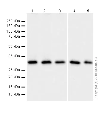 Western blot - Anti-REA antibody [EPR14523] (AB182139)