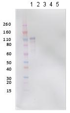 Western blot - Anti-REBOV GP antibody (AB190658), expandable thumbnail