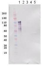 Western blot - Anti-REBOV GP antibody (AB190658), expandable thumbnail