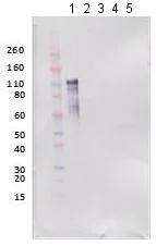 Western blot - Anti-REBOV GP antibody (AB190658)