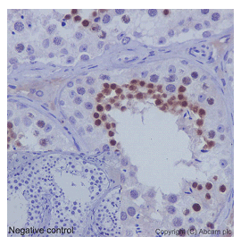 Immunohistochemistry (Formalin/PFA-fixed paraffin-embedded sections) - Anti-REC8 antibody [EPR16189] (AB192241)