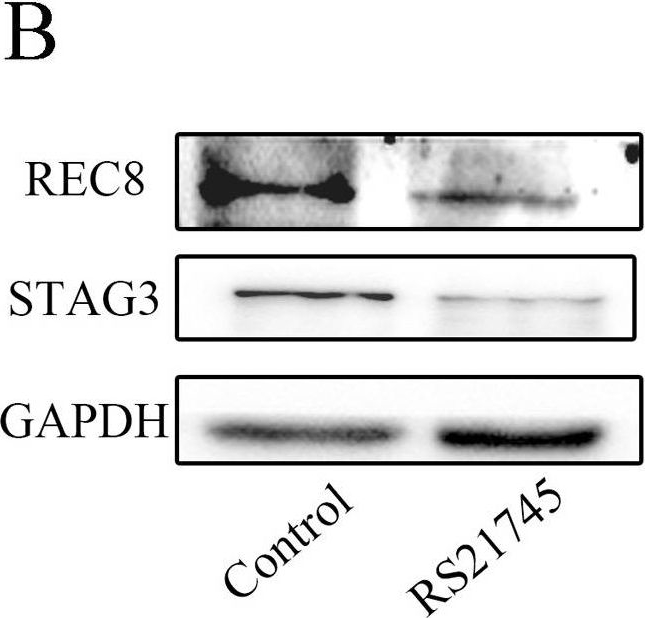 Western blot - Anti-REC8 antibody [EPR16189] (AB192241)