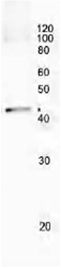 Immunoprecipitation - Anti-RecA antibody (AB63797)