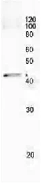 Immunoprecipitation - Anti-RecA antibody (AB63797)