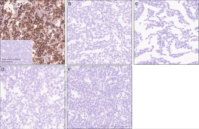 Immunohistochemistry (Formalin/PFA-fixed paraffin-embedded sections) - Anti-RecA antibody [EPR29094-561] (AB323376)
