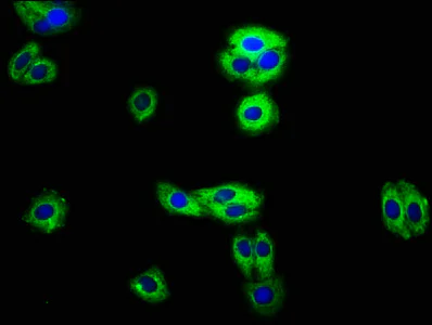 Immunocytochemistry/ Immunofluorescence - Anti-RECK antibody (AB238162)