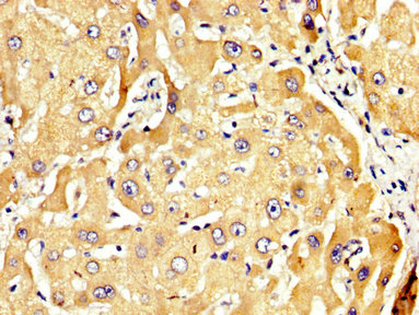 Immunohistochemistry (Formalin/PFA-fixed paraffin-embedded sections) - Anti-RECK antibody (AB238162)