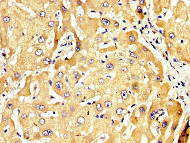 Immunohistochemistry (Formalin/PFA-fixed paraffin-embedded sections) - Anti-RECK antibody (AB238162)