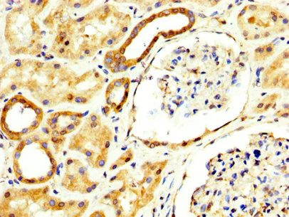 Immunohistochemistry (Formalin/PFA-fixed paraffin-embedded sections) - Anti-RECK antibody (AB238162)
