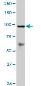 Western blot - Anti-RECK antibody (AB88249)