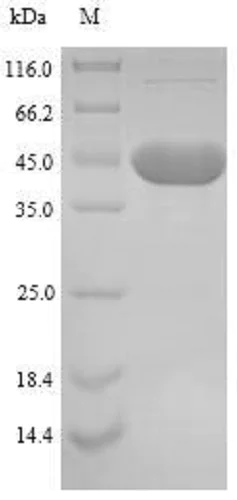 SDS-PAGE - Recombinant 46 kDa surface antigen protein (His tag) (AB240866)