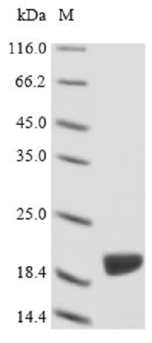 SDS-PAGE - Recombinant Actin protein (Tagged) (AB235861)