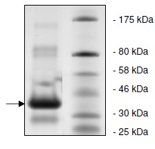 SDS-PAGE - Recombinant ADA protein (AB135018)