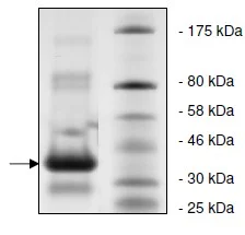SDS-PAGE - Recombinant ADA protein (His tag N-Terminus) (AB135018)