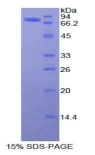 SDS-PAGE - Recombinant Angiotensinogen (AGT) (AB316920), expandable thumbnail