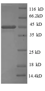 SDS-PAGE - Recombinant B. pertussis Pertactin autotransporter protein (Tagged) (AB224861)