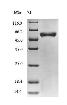 SDS-PAGE - Recombinant BH0637 protein (Tagged) (AB239565)