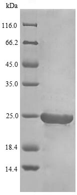 SDS-PAGE - Recombinant Chicken Interferon beta protein (His tag) (AB239440)