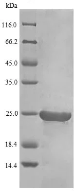 SDS-PAGE - Recombinant Chicken Interferon beta protein (His tag) (AB239440)