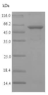 SDS-PAGE - Recombinant Chlamydia trachomatis Chlamydia trachomatis MOMP protein (Tagged) (AB226442)