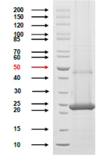 SDS-PAGE - Recombinant Chlamydia trachomatis MOMP protein (AB274664), expandable thumbnail