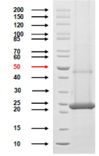 SDS-PAGE - Recombinant Chlamydia trachomatis MOMP protein (AB274664)