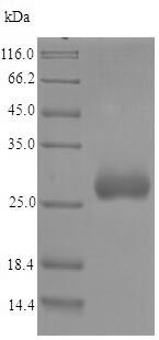 SDS-PAGE - Recombinant Chlamydia trachomatis omcA protein (His tag) (AB224841)