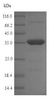 SDS-PAGE - Recombinant Chlamydia trachomatis OmcB protein (His tag) (AB224862), expandable thumbnail
