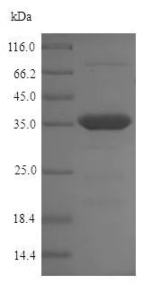 SDS-PAGE - Recombinant Chlamydia trachomatis OmcB protein (His tag) (AB224862)
